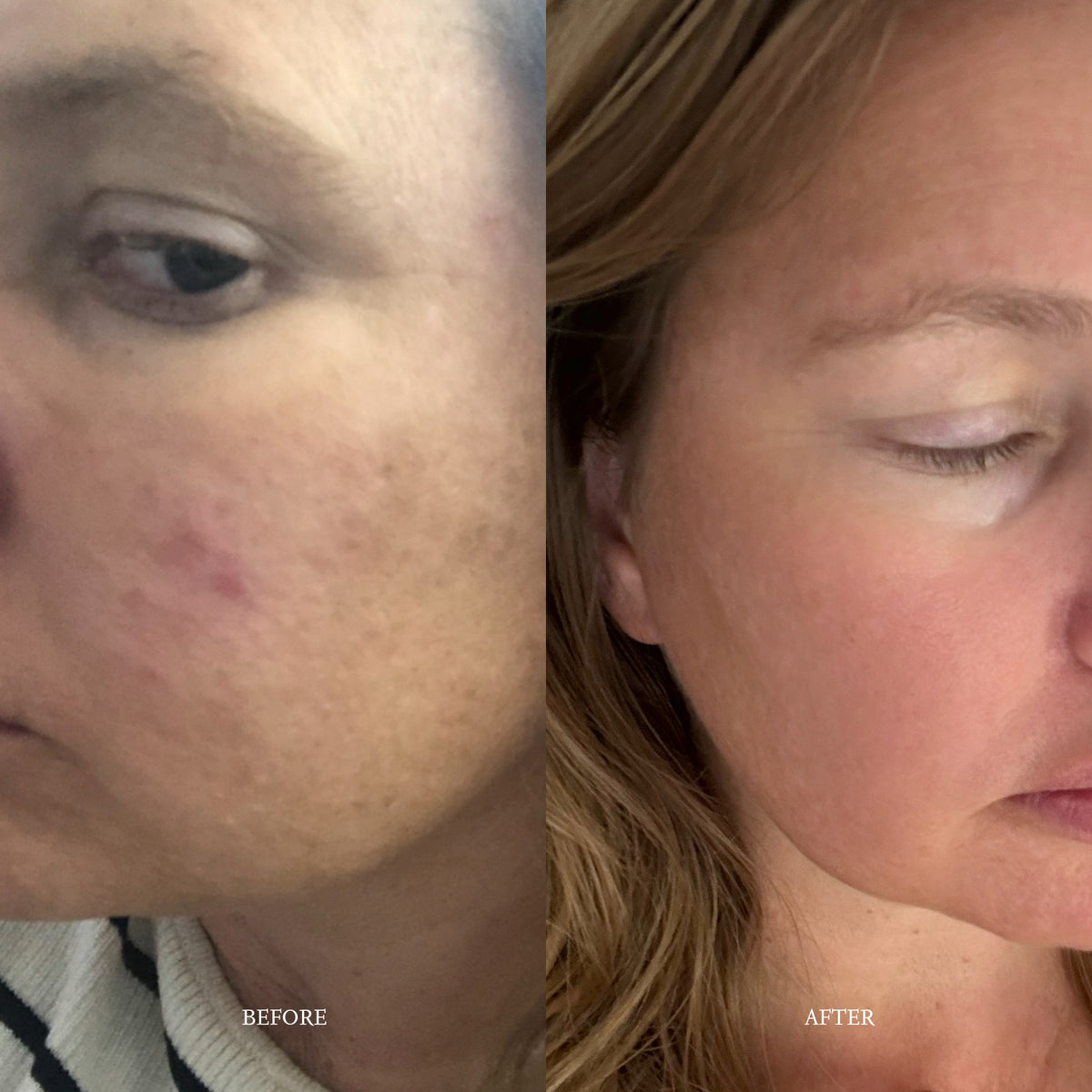 Bakuchiol Phyto-lipid No. 3 Drops - Perception Skin