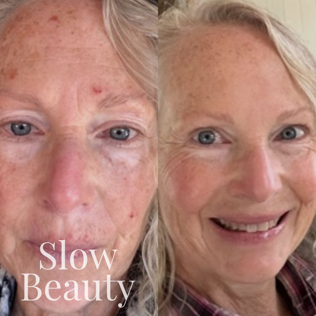 Why Perception Skin Works for Both Young and Mature Skin