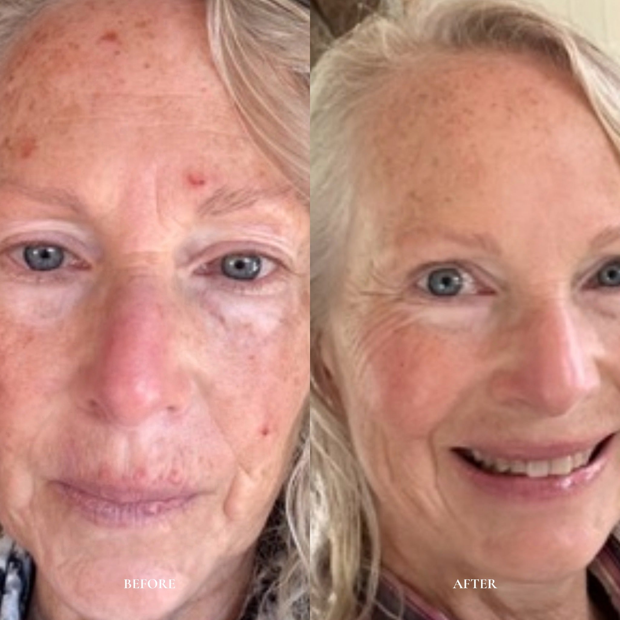 The Australian Native 6-Ritual Method - Perception Skin